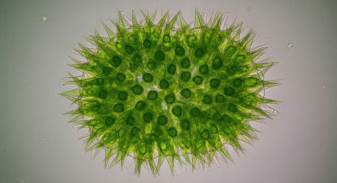 Green Algae Microscopic Organism Biology Spiky Freshwater Plant Cells Microbiology Detail Volvox Globator Close Up Under Microscope