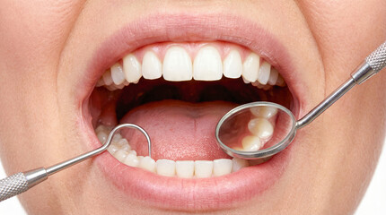 Close-up of patient open mouth with healthy teeth undergoing dental examination with mirror and probe tools