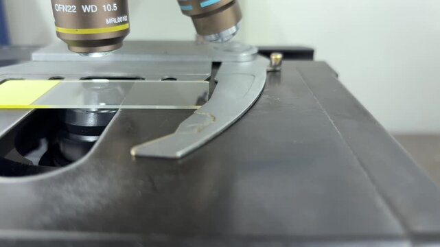 Placing a Yellow Microscope Slide on the Stage for Laboratory Examination