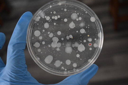 Bacterial colonies growing on an agar plate in a Petri dish in a microbiology laboratory. This is a common method used in microbiology to culture and count microorganisms.