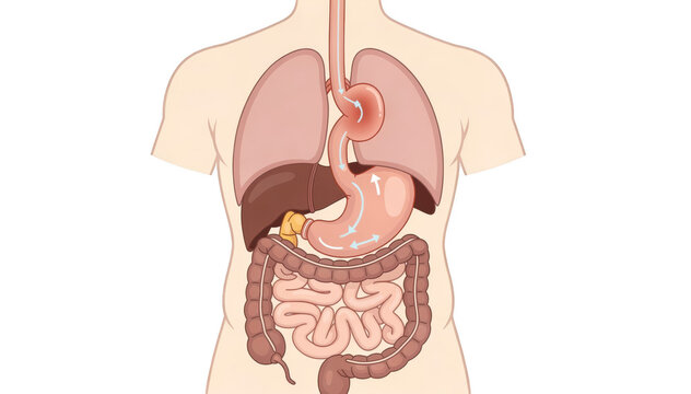 Simplified patient handout style illustration of the diaphragm and stomach highlighting a hiatal hernia causing acid reflux with clear anatomical labels isolated on white.