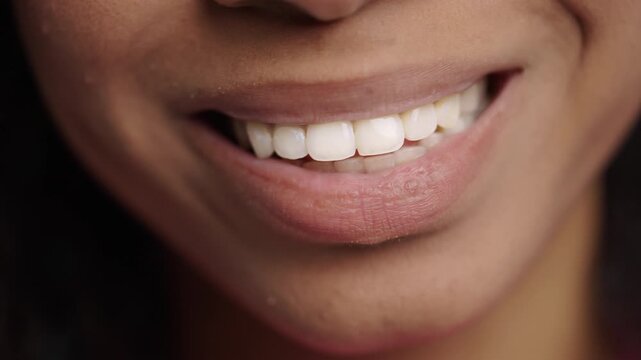Close-Up Of Smiling African Teenage Girl, Natural Lips. Beauty, problematic skin