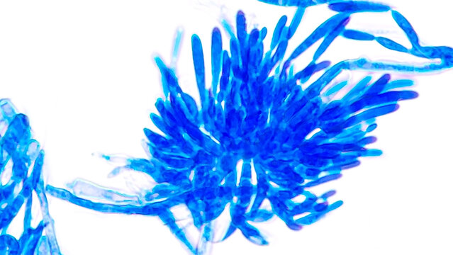 Fusarium citri sporodochial conidiophores bearing macroconidia under microscope. Lactophenol blue staining