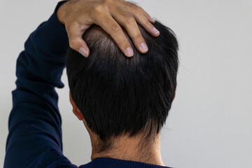 薄毛の後頭部を手で隠す男性（日本人、30代）