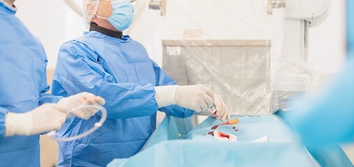 In a well-equipped medical room, healthcare professionals prepare for a TransArterial...