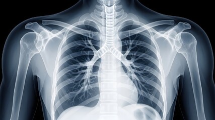 X-ray of human chest