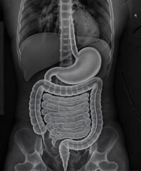 X-ray image of human digestive system
