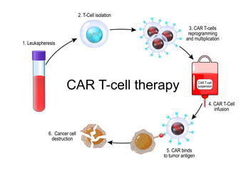 CAR T-cell therapy. Cancer immunotherapy. CAR-T cell for killing of tumor