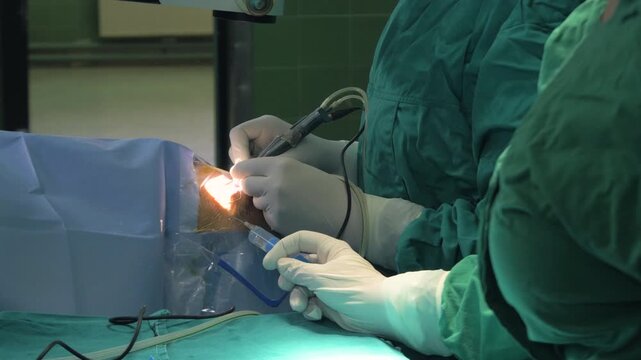 Close-up of a surgeon's hands, phacoemulsification procedure during cataract eye surgery