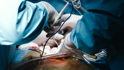 Surgical team performing intricate procedure in operating room, showcasing advanced medical tools and sterile environment, emphasizing precision and teamwork in healthcare