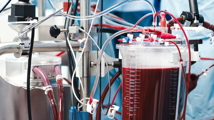 Medical equipment in an operating room, showcasing advanced technology and blood collection apparatus, emphasizing surgical precision and healthcare innovation