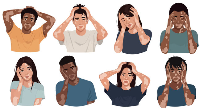 Diverse people with vitiligo expressing concern
