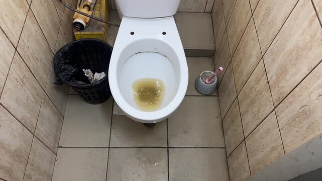 Extremely dirty and clogged toilet filled with waste, stained porcelain bowl, water overflow, and grime buildup creating an unhygienic and blocked mess.