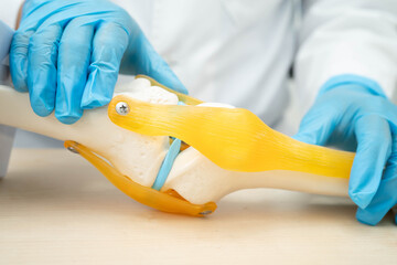 Asian doctor holding spinal nerve and bone model, Lumbar spine displaced herniated disc fragment for treatment medical in the orthopedic department.