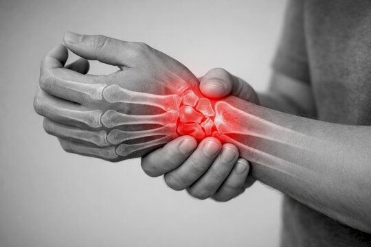Wrist pain and joint inflammation medical concept with x-ray overlay