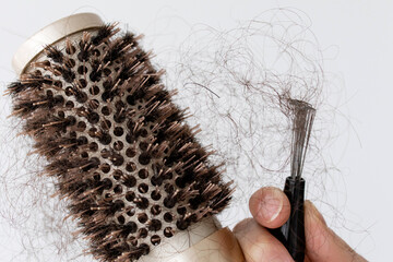 Close-up of round hairbrush with clumps of fallen hair, symbolizing hair loss caused by vitamin...