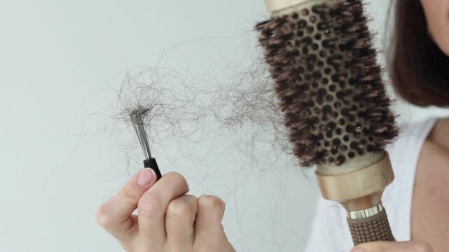 Round hairbrush with clumps of fallen hair, symbolizing hair loss caused by vitamin deficiency, low ferritin, protein shortage or hormonal imbalance. Alopecia, malnutrition, and female health issue.