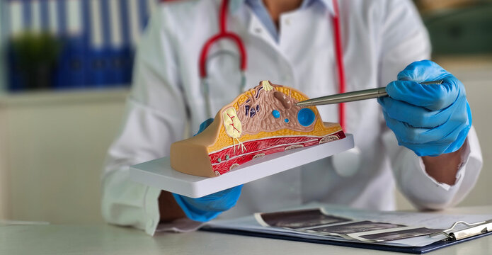 Female doctor explains the disease using an anatomical model of breast