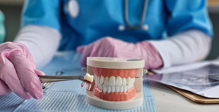 Tooth extraction and pediatric teeth surgery concept. Caries and dental treatment concept