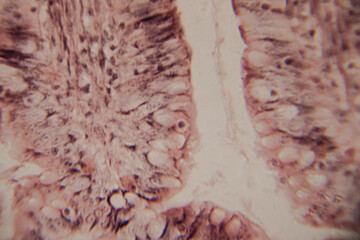 Microscopic image showing a cross-section of human intestinal villi with epithelial cells, nuclei, and goblet cells visible.