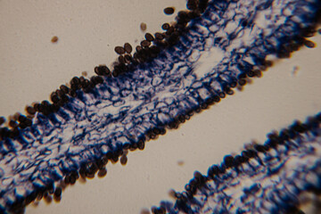 Stained histological slide showing columnar epithelial cells lining a lumen, with connective tissue structure on the right side under magnification.