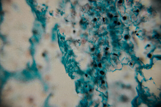 Microscopic view of stained fungal hyphae and spores with visible structures in blue against a beige background. Includes areas of blur and copy space.