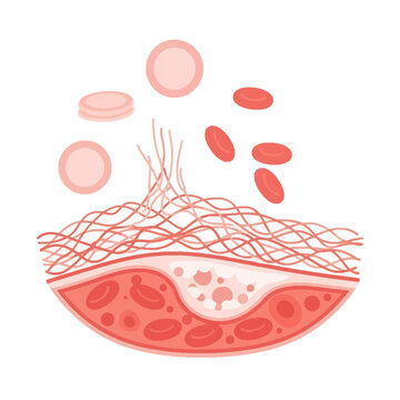 Blood Clot Formation Process Vector Illustration Showing Thrombosis and Hemostasis in Human Circulation
