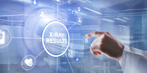 A radiologist analyzes detailed X-ray results on a digital medical viewing screen