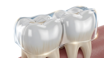 Close-up view of dental molar teeth with shiny crowns on a white background