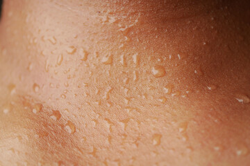 sweating on skin after exercise in warm weather