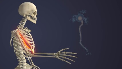 Motor Neuron Disease Causing Skeletal Muscle Weakness