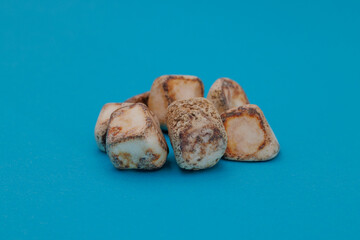 手術で摘出された多数の胆石、青背景