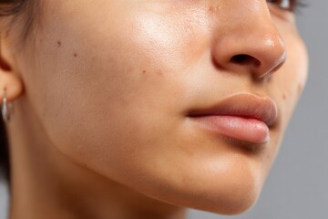 Woman displaying beauty and health with blemishes on her face