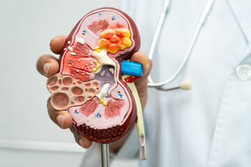 Cardiovascular disease CVD, Asian doctor holding human anatomy model for learn and treat heart disease.