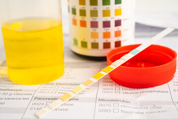 Urinalysis, urine cup with reagent strip pH paper test and comparison chart in laboratory.