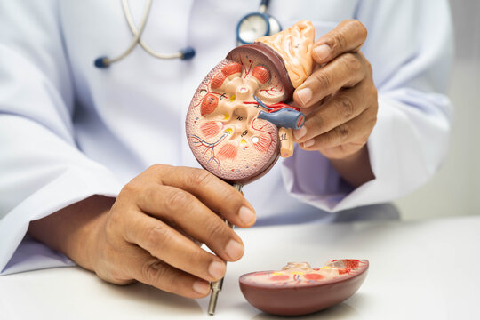 Chronic kidney disease, doctor with model for treatment urinary system, urology, Estimated glomerular filtration rate eGFR.