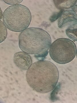 Microscopic Morphological Analysis of Tulipa Gesneriana Pollen Grains and Structure