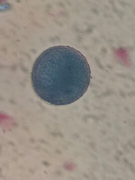 Microscopic Morphological Analysis of Tulipa Gesneriana Pollen Grains and Structure