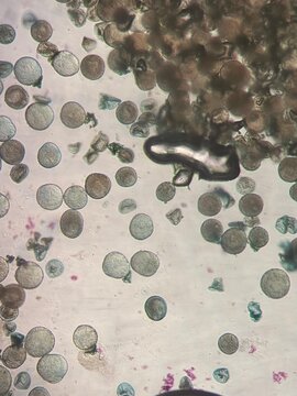 Microscopic Morphological Analysis of Tulipa Gesneriana Pollen Grains and Structure
