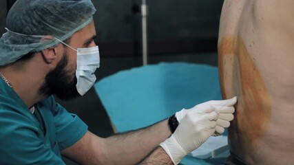 Male anesthesiologist administering spinal anesthesia injection into patient's back