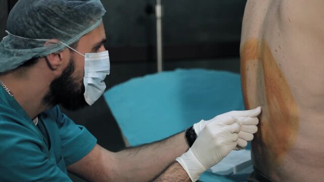 Male anesthesiologist administering spinal anesthesia injection into patient's back