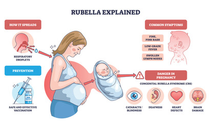 Rubella explained shows how infection spreads, risks in pregnancy and newborn outcomes, key elements, pregnant woman, infant, vaccine icons. Outline diagram