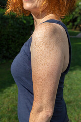 Side view of freckled arm and shoulder of fair-skinned red-haired woman