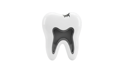 Cross-section of a human tooth with decay and pulp