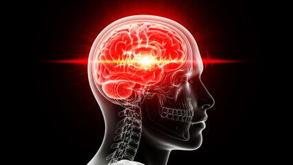 Brain with Red Glow Indicating Pain and Glowing Brainwaves in Human Skull