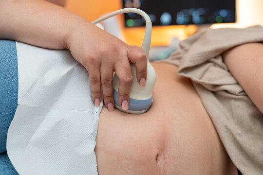 Pregnant woman getting an abdominal ultrasound scan detecting fetal heartbeat and monitoring prenatal health