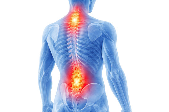 Human spine anatomy showing cervical thoracic lumbar pain inflammation back view medical illustration isolated on white background