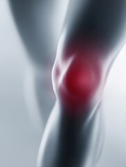 Knee injury awareness, joint pain and mobility problem