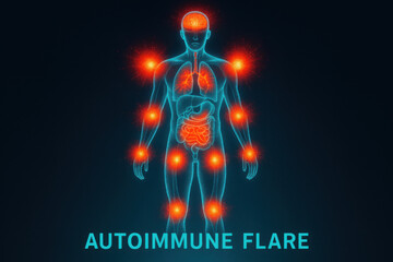 Autoimmune flare visualization showing intense pain from red immune hotspots. medical diagram of human body with chronic inflammation and disease attacking multiple organ