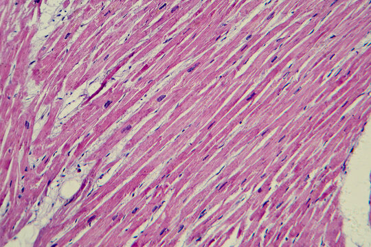 Cardiac hypertrophy, light micrograph